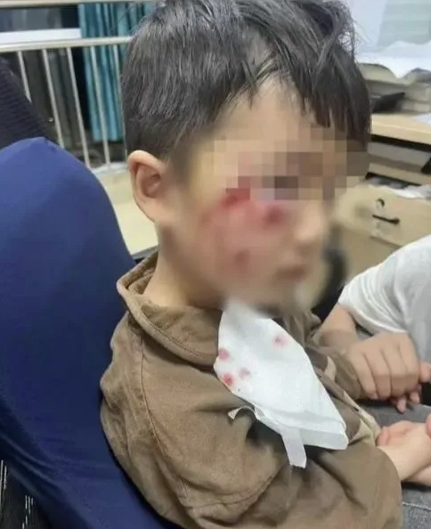 被瘋?cè)麤](méi)有“救命藥”，怎么辦？